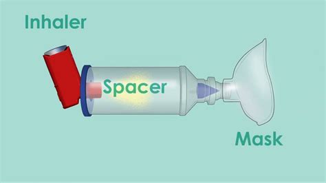 酸素吸入器 医療用 - 酸素吸入器が宇宙旅行に必要な理由